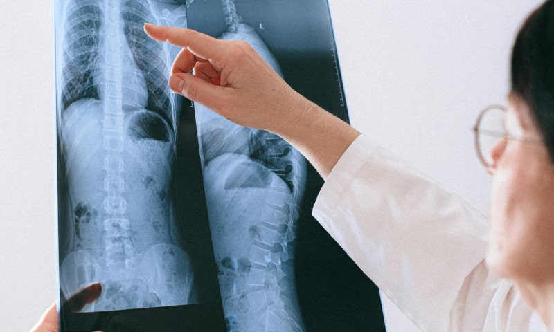 Doctor examining an x-ray